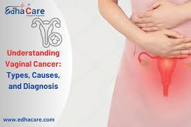 Comprehensive Care for Vaginal Cancer in India - Image 1