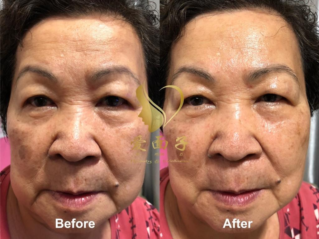 Mobile Facial Treatment Services in Tampines - Image 3