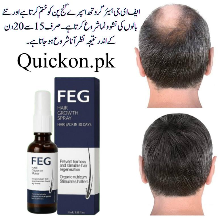 FEG Plus Hair Growth Spray In Rajanpur Usage and Safety Guide in Lahore - Image 1