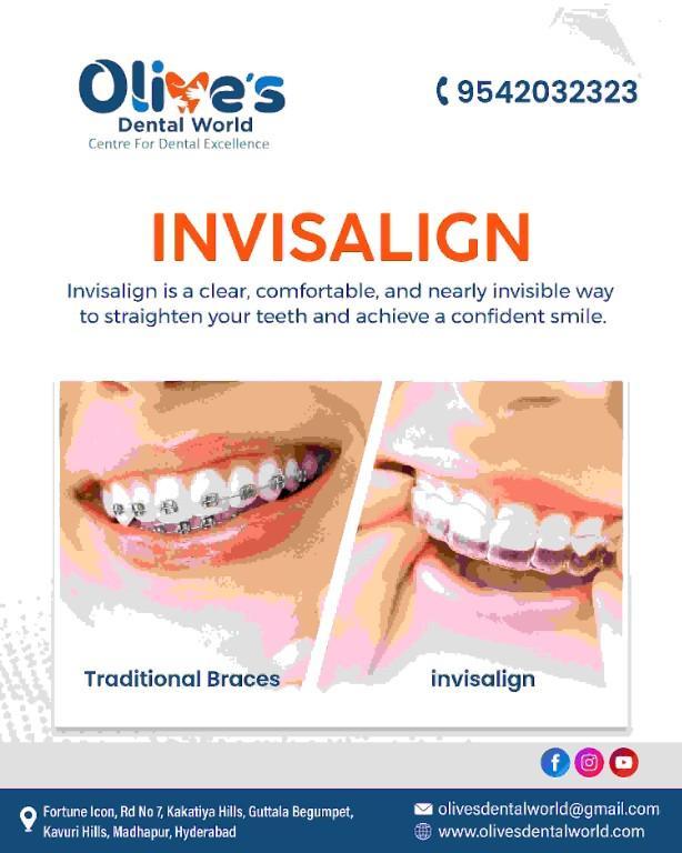 How to Choose the Best Invisalign Treatment for You in India - Image 1