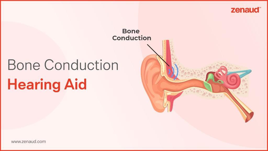 Bone Conduction Hearing Aid - Zenaud in Mathikere - Image 1