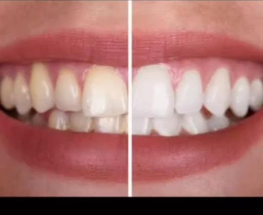 CLINICA DENTAL KORSO en Caracas - Imagen 2