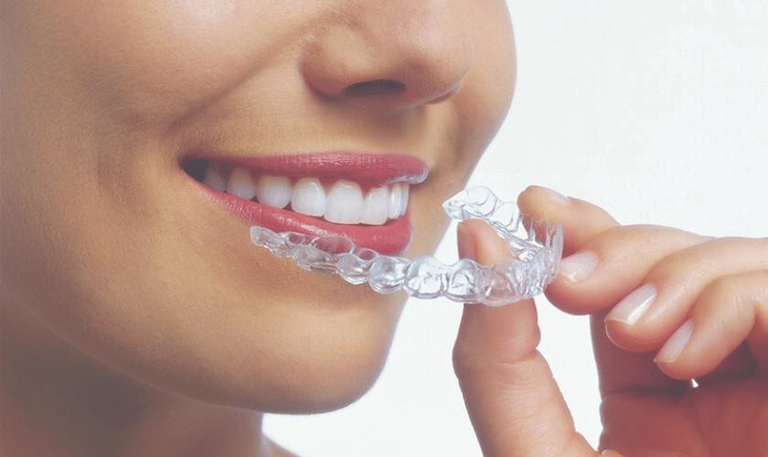 Best Invisalign Provider in Bikaner in Bikaner - Image 1