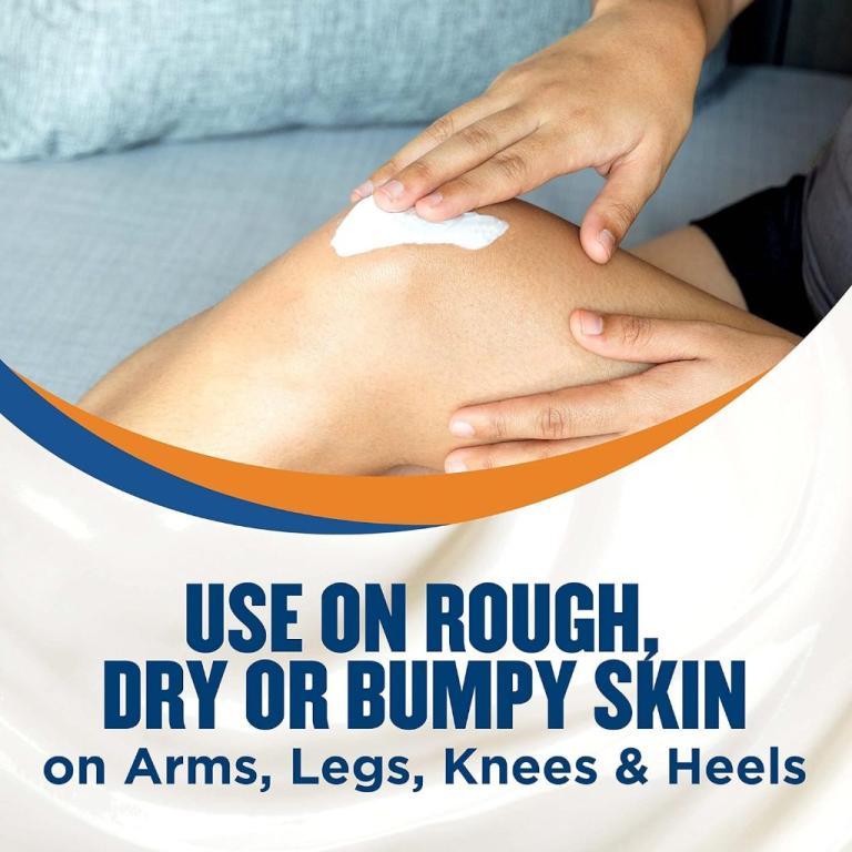 NEW LABEL Gold Bond Ultimate Rough & Bumpy Skin Daily … in Geylang - Image 1