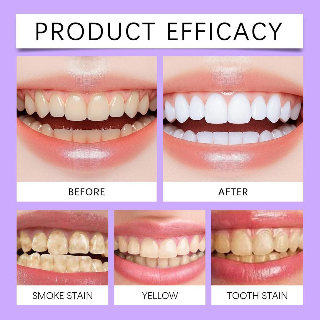 Tooth Refresh Toothpaste 3pcs, Fresh Breath Whitening … in Toa Payoh - Image 1