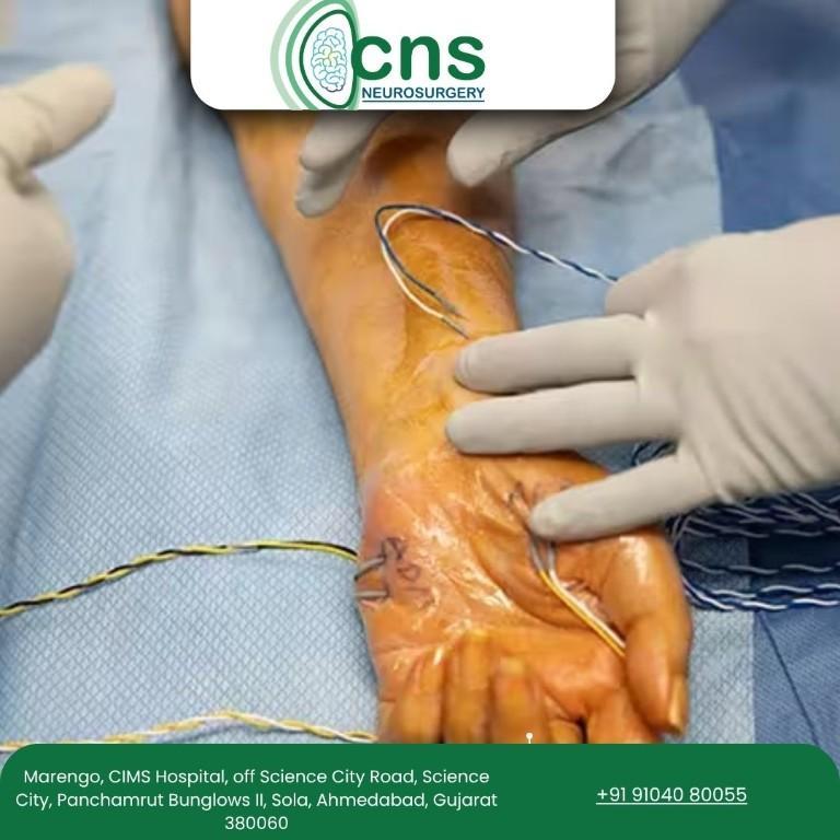 Restore Nerve Function with Expert Peripheral Nerve Surgery in Ahmedabad - Image 1