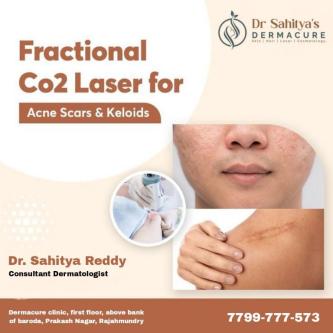 Best Keloid Treatment In Rajahmundry in Patamata - Image 1