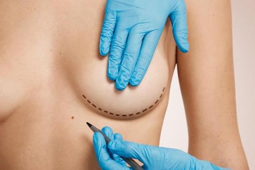 Breast Reduction Surgery in Riyadh in Dwārka - Image 2