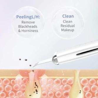 Electric Skin Scraper Peeling Blackhead Remover Ultrasonic … in Kota Kinabalu - Image 1