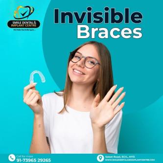 How Invisible Braces Fix Crooked Teeth in As Rao Nagar in Bolārum - Image 1