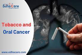 How Tobacco Contributes to Oral Cancer Risk in Gurgaon - Image 1