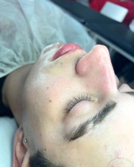 LIMPIEZAS FACIALES en Sarandí - Imagen 1