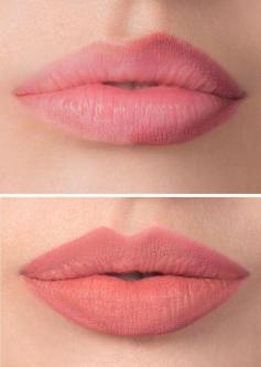 MICROPIGMENTACIONES DE LABIOS en La Florida - Imagen 5
