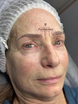 Microblading(permanent makeup) in New Westminster - Image 5
