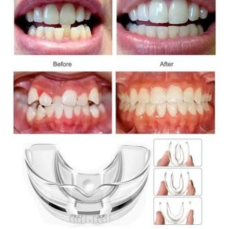 Teeth Braces R1000 in Durban - Image 4