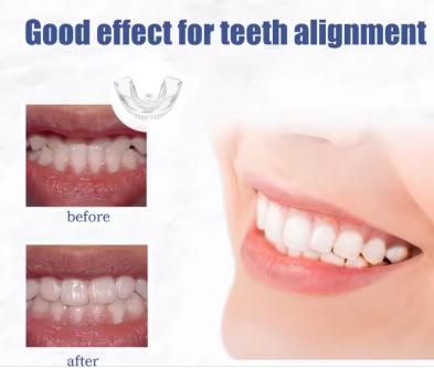 Teeth Braces R1000 in Durban - Image 2