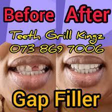 Tooth Repair FIXERS in Durban - Image 1