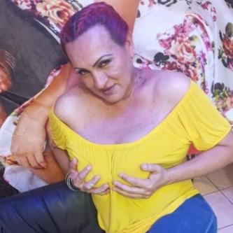 Trans operada bubis en Villahermosa - Imagen 1